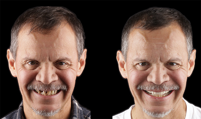 Blue Island Smiles | Laser Dentistry, Teeth Whitening and TMJ Disorders