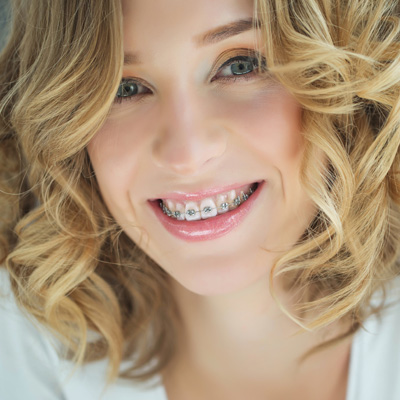 Blue Island Smiles | Dentures, TMJ Disorders and Sports Mouthguards