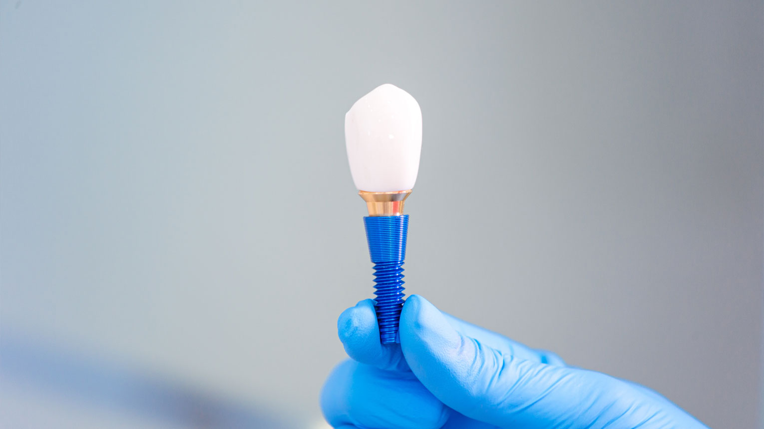 Dental Implants vs. Dentures